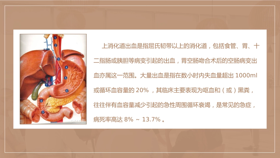 急诊护理：上消化道出血护理查房_第4页