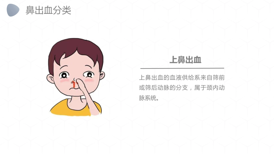急诊护理：鼻出血护理诊断措施_第5页