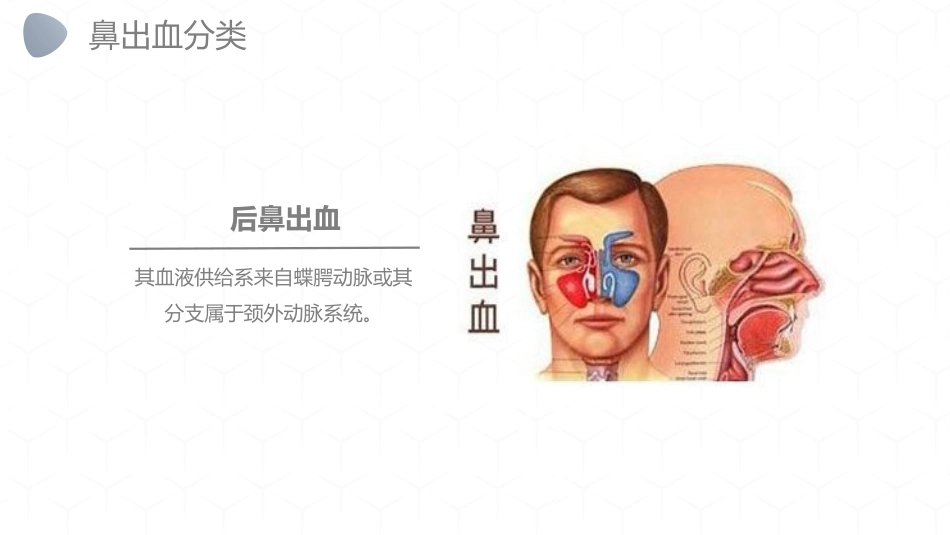 急诊护理：鼻出血护理_第6页