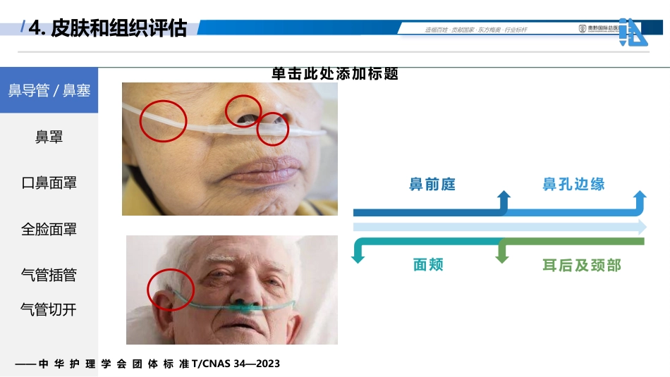 成人呼吸支持治疗器械相关压力性损伤的预防(中华护理学会团体标准解读)_第13页