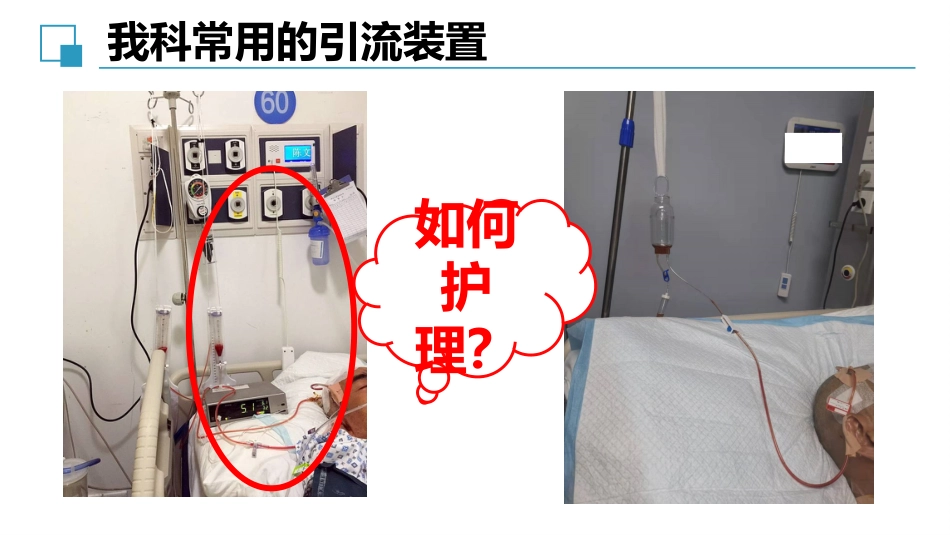 脑室外引流管的护理完整版_第14页