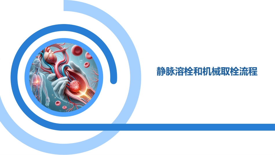 急性缺血性卒中再灌注治疗指南2024解读_第3页