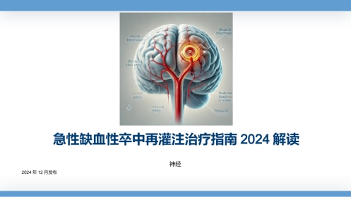 急性缺血性卒中再灌注治疗指南2024解读