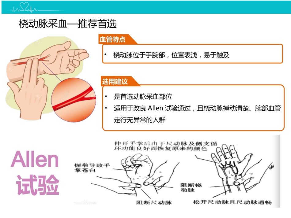 动脉血气分析临床操作实践标准精讲_第10页