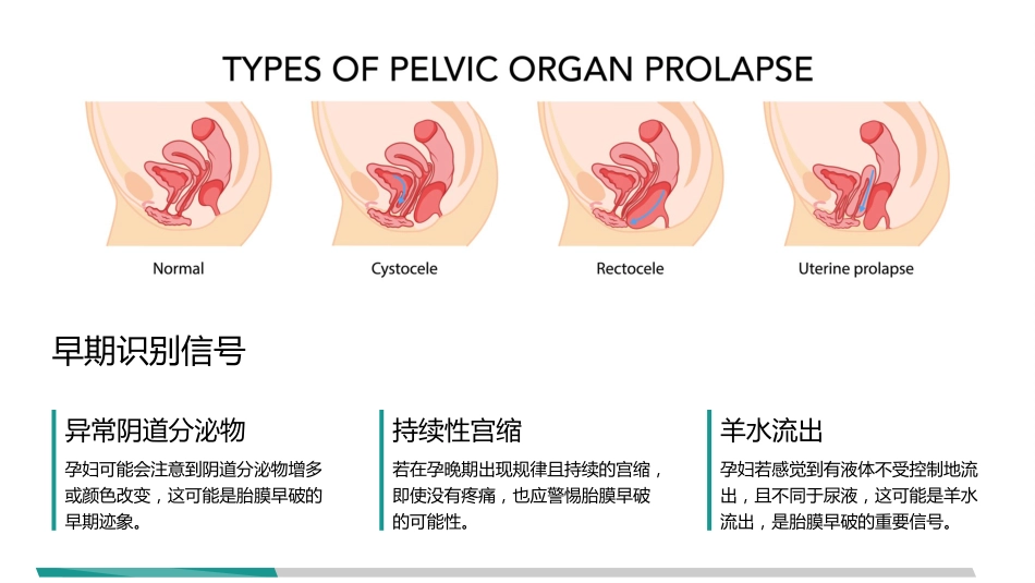 胎膜早破指南解读_第11页