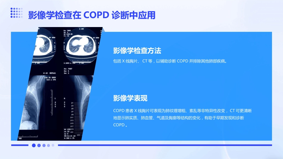 《中国慢性阻塞性肺疾病基层诊疗与管理指南(2024年)》解读PPT课件_第14页