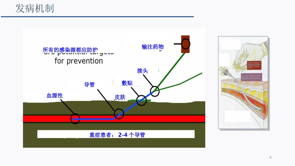 侵入性操作相关感染防控_第8页