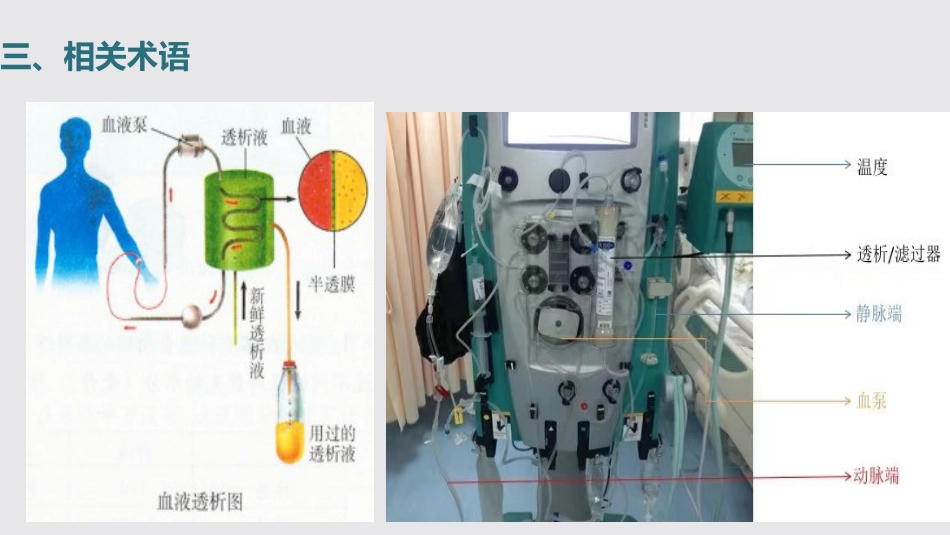 连续性肾脏替代治疗的护理2023中华护理学会团体标准_第11页