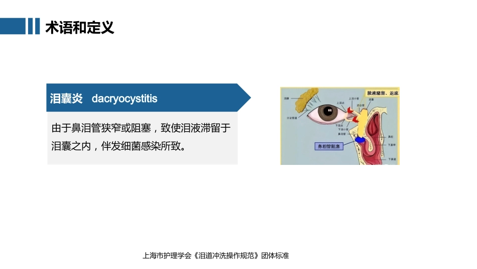 泪道冲洗技术-2025中华护理学会团体标准_第12页