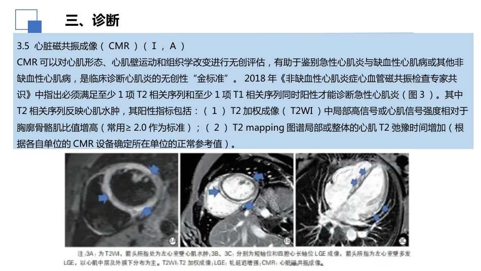 2024年中国成人心肌炎临床诊断与治疗指南解读课件_第15页