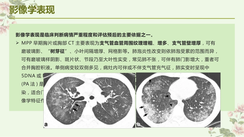 儿童肺炎支原体肺炎诊疗指南(2023年版)解读_第7页