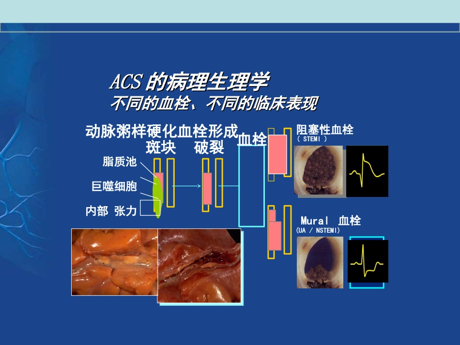 从最新指南看抗血小板药物的使用课件_第3页