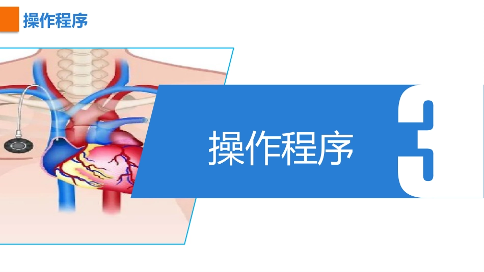 植入式静脉给药装置（输液港）-中华护理学会团体标准2023_第10页
