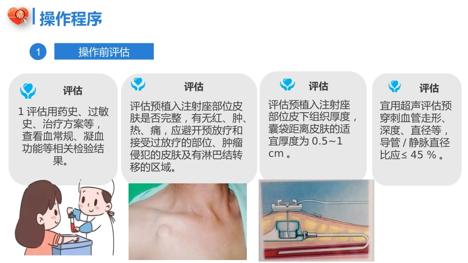 植入式静脉给药装置（输液港）-中华护理学会团体标准2023_第11页