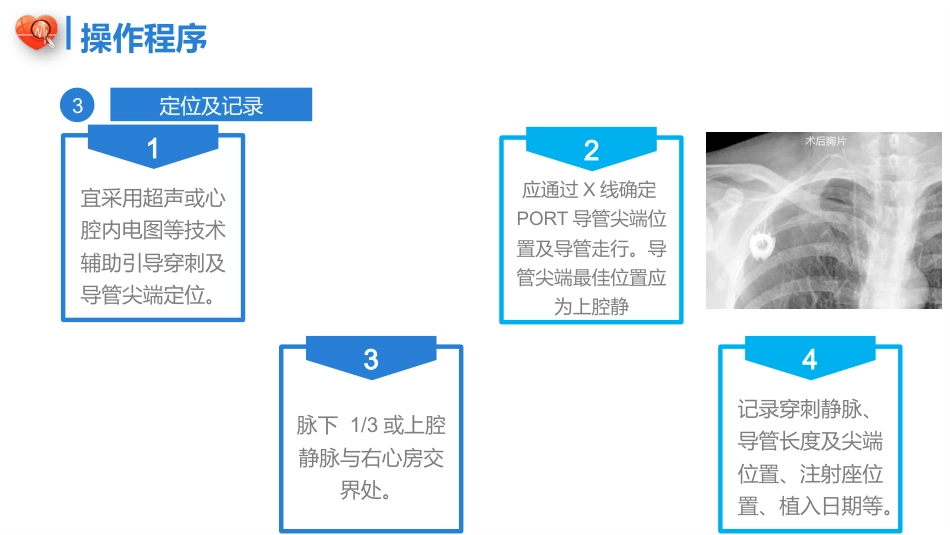 植入式静脉给药装置（输液港）-中华护理学会团体标准2023_第14页