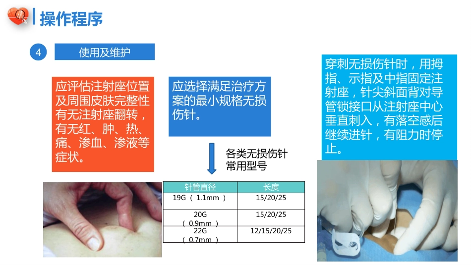 植入式静脉给药装置（输液港）-中华护理学会团体标准2023_第15页