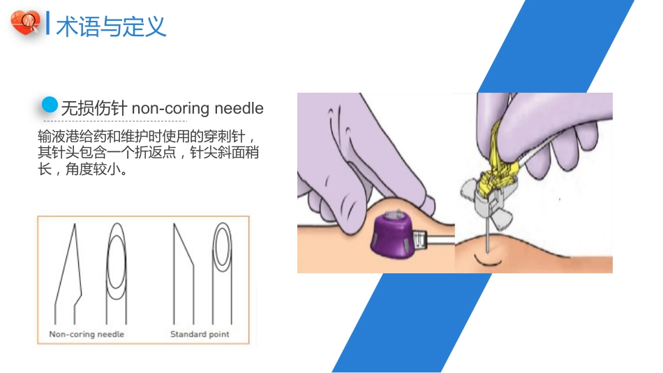 植入式静脉给药装置（输液港）-中华护理学会团体标准2023_第7页