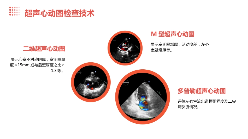 2024肥厚型心肌病指南_第14页