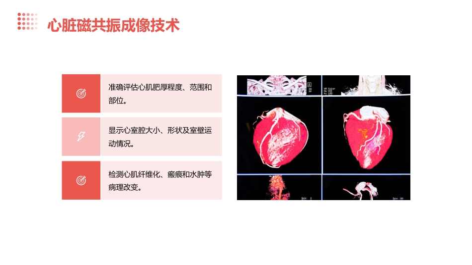 2024肥厚型心肌病指南_第15页