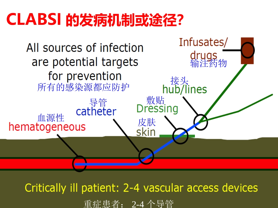 侵入性操作相关感染防控 (2)_第14页