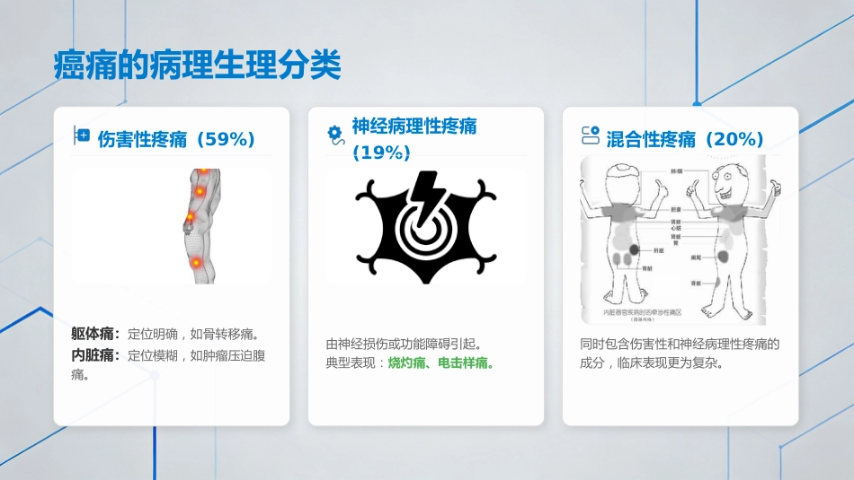 中国成人癌痛诊疗指南（202X版）解读_第11页