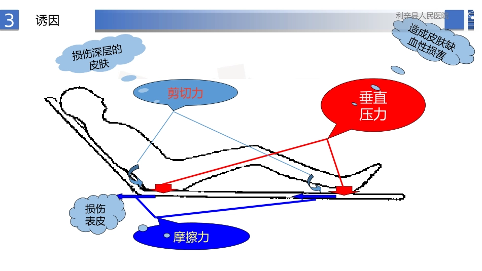 压力性损伤预防护理实操指南_第14页