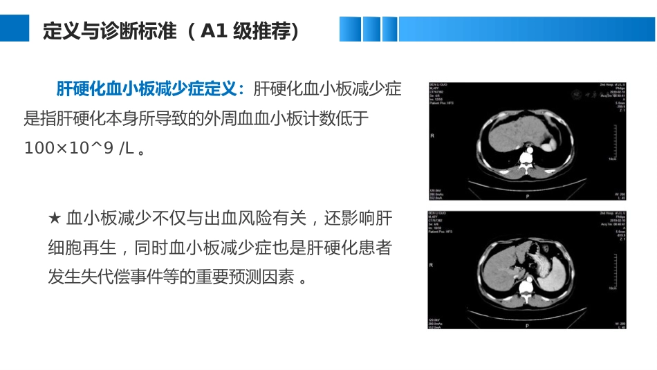肝硬化血小板减少症临床管理实用指南_第5页