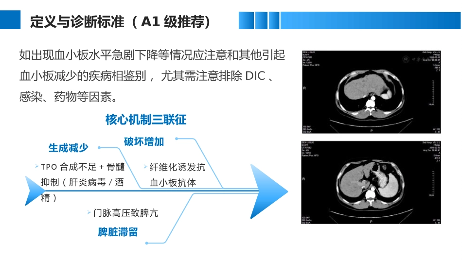 肝硬化血小板减少症临床管理实用指南_第6页