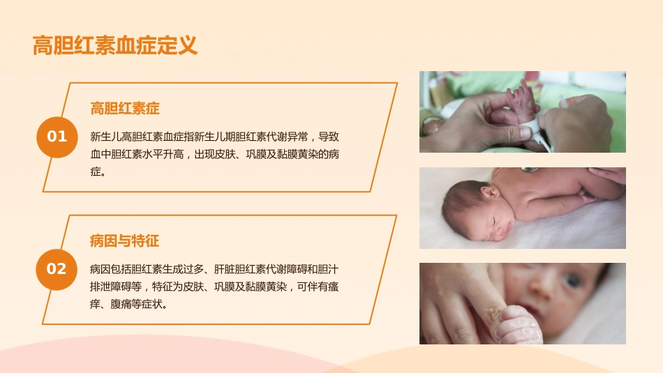 新生儿高胆红素血症诊治指南(2025)解读PPT_第12页