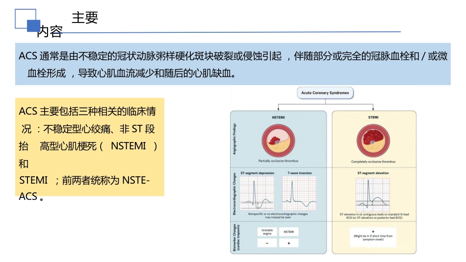 2025美急性冠脉综合征(ACS)患者管理指南解读课件_第6页