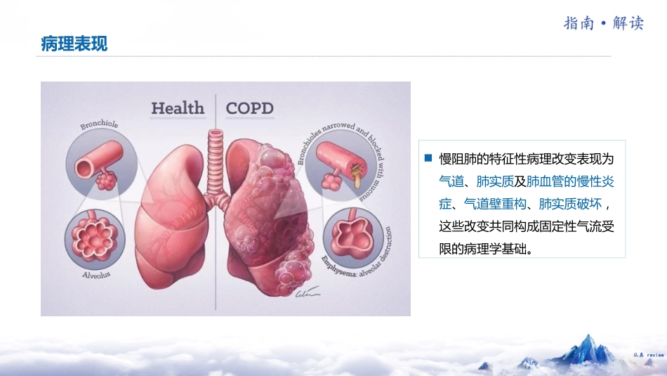 中国慢性阻塞性肺疾病基层诊疗指南(2024年)解读_第15页