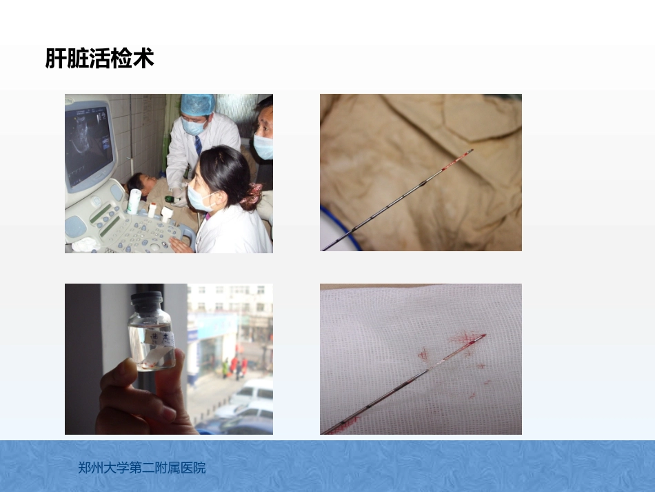 原发性肝癌诊疗指南解读_第11页