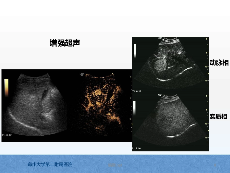 原发性肝癌诊疗指南解读_第8页