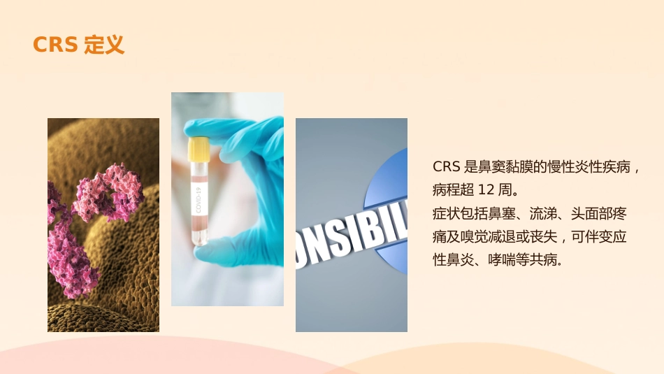 《慢性鼻窦炎诊断和治疗指南(2024)》解读_第7页