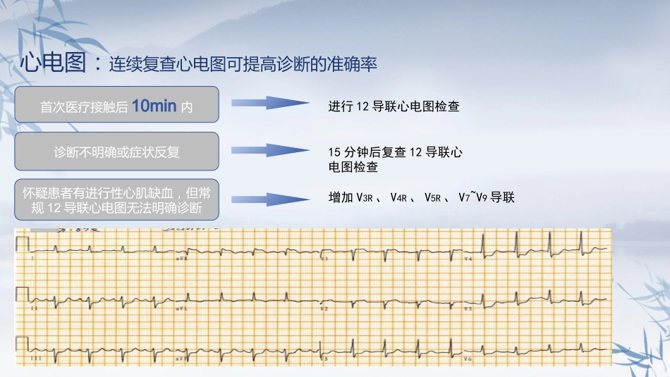非ST段抬高型急性冠脉综合征诊断和治疗指南(2024）_第4页