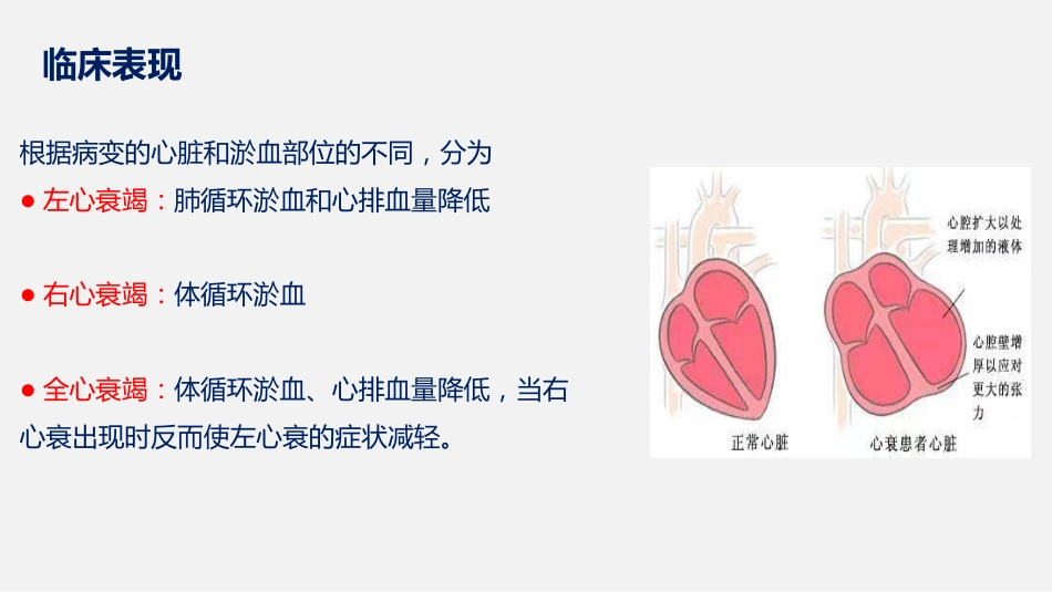 心力衰竭患者护理查房课件_第8页