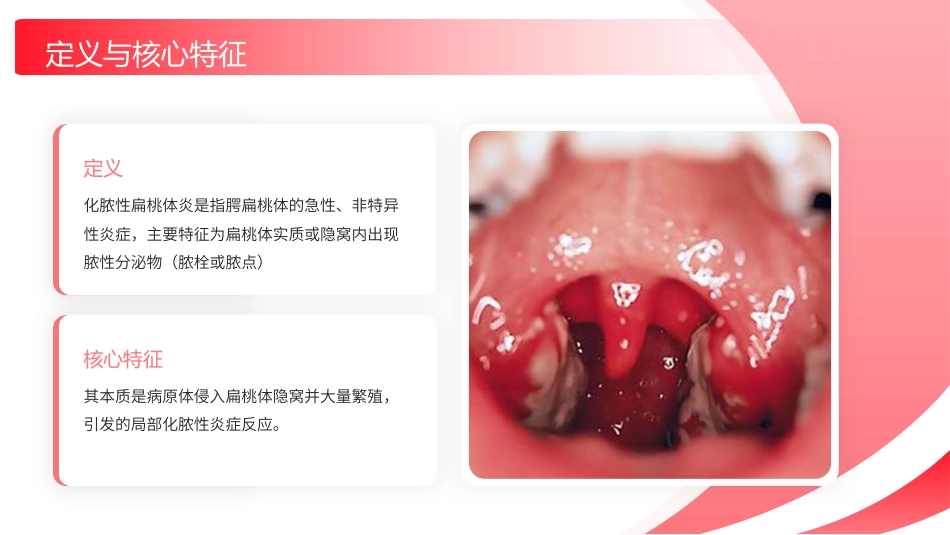 化脓性扁桃体炎护理查房带参考文献_第4页