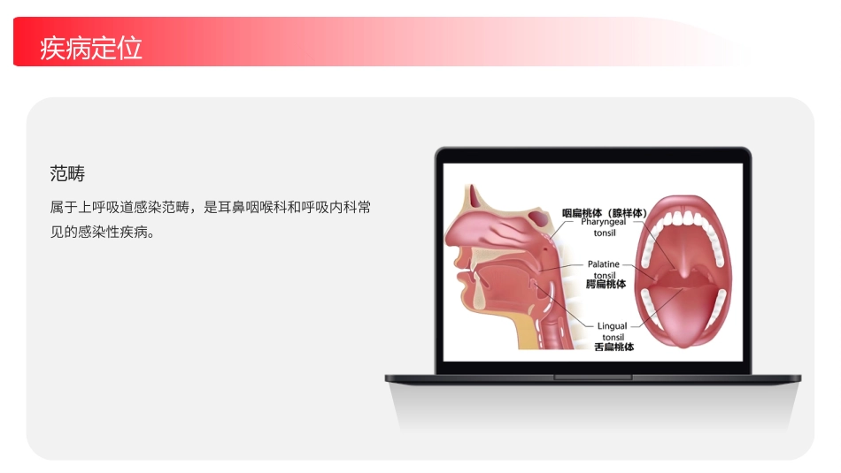 化脓性扁桃体炎护理查房带参考文献_第5页