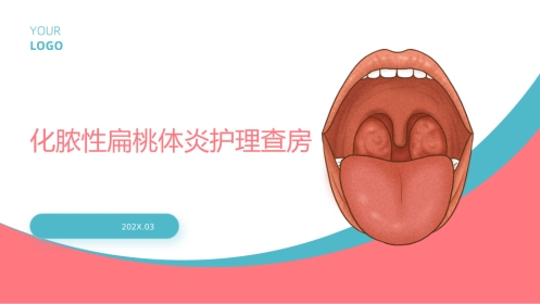 化脓性扁桃体炎护理查房带参考文献