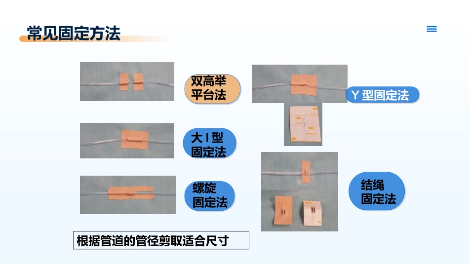 临床各类引流管的固定及规范管理_第10页
