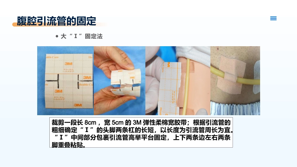 临床各类引流管的固定及规范管理_第12页