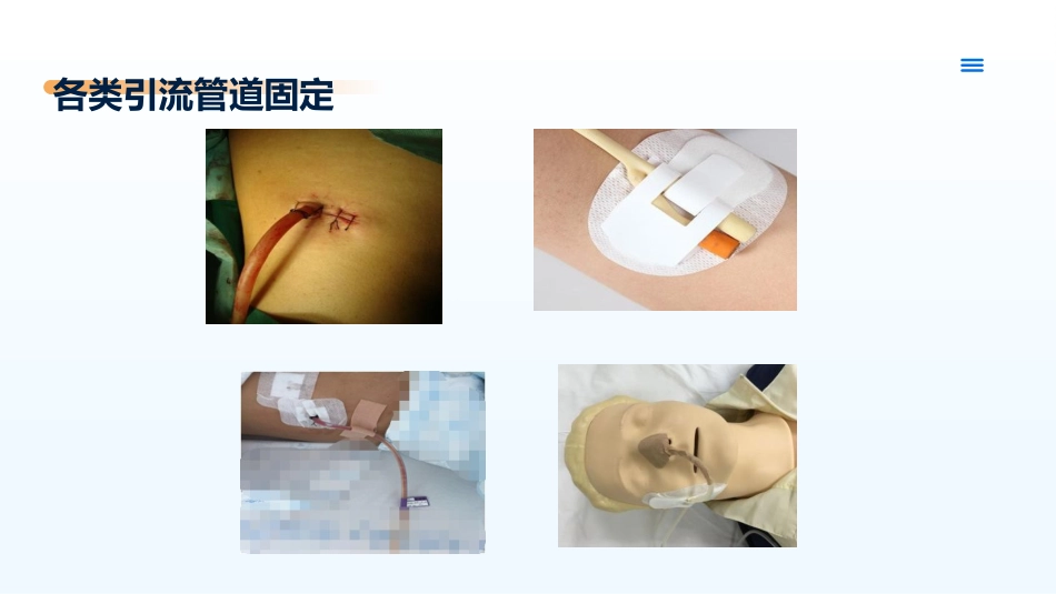 临床各类引流管的固定及规范管理_第5页