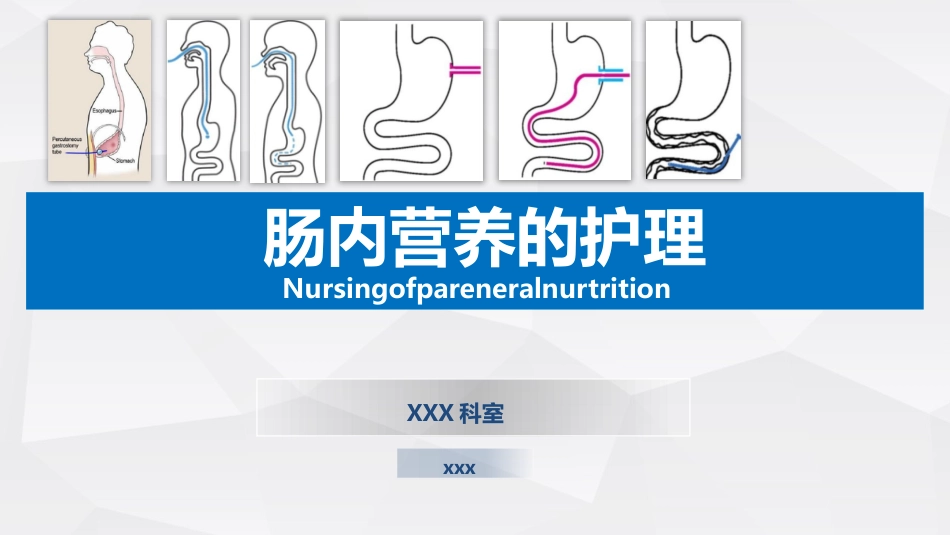 肠内营养的护理_第1页