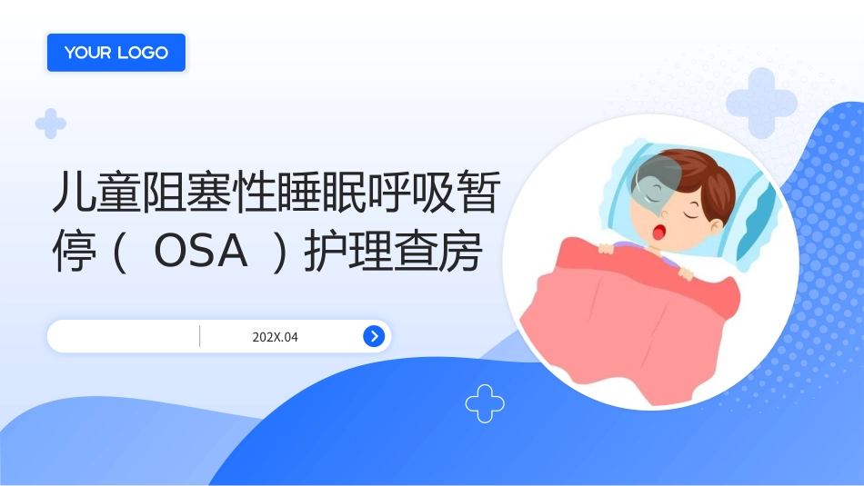 儿童阻塞性睡眠呼吸暂停（OSA）护理查房带参考文献_第1页