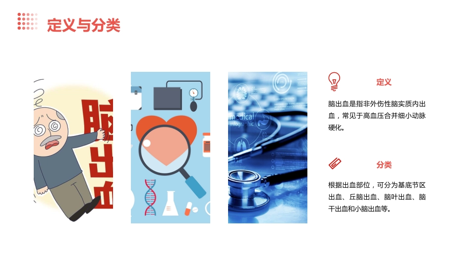 脑出血临床管理指南(2023版)解读PPT课件_第8页
