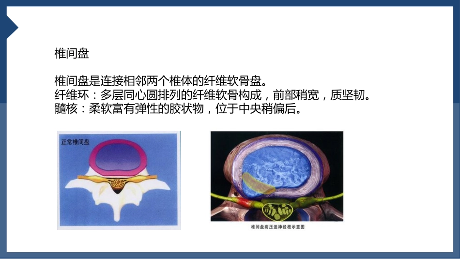 颈椎病_第10页