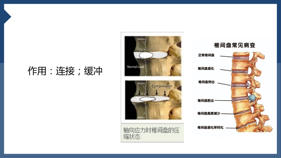 颈椎病_第11页