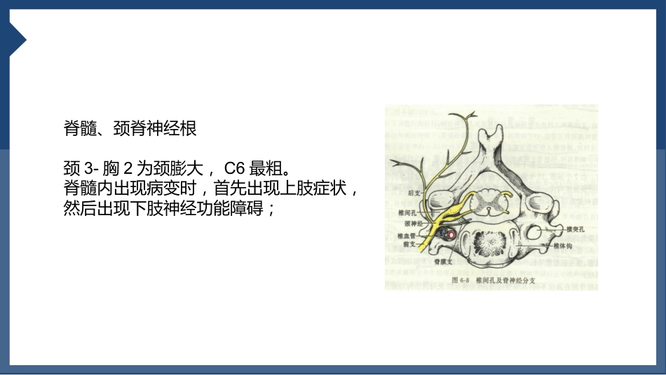 颈椎病_第15页