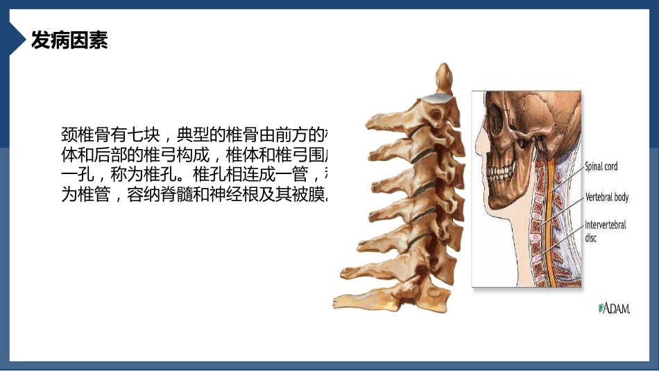 颈椎病_第5页