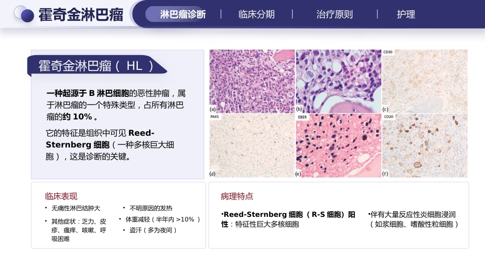 淋巴瘤的治疗与护理_第12页